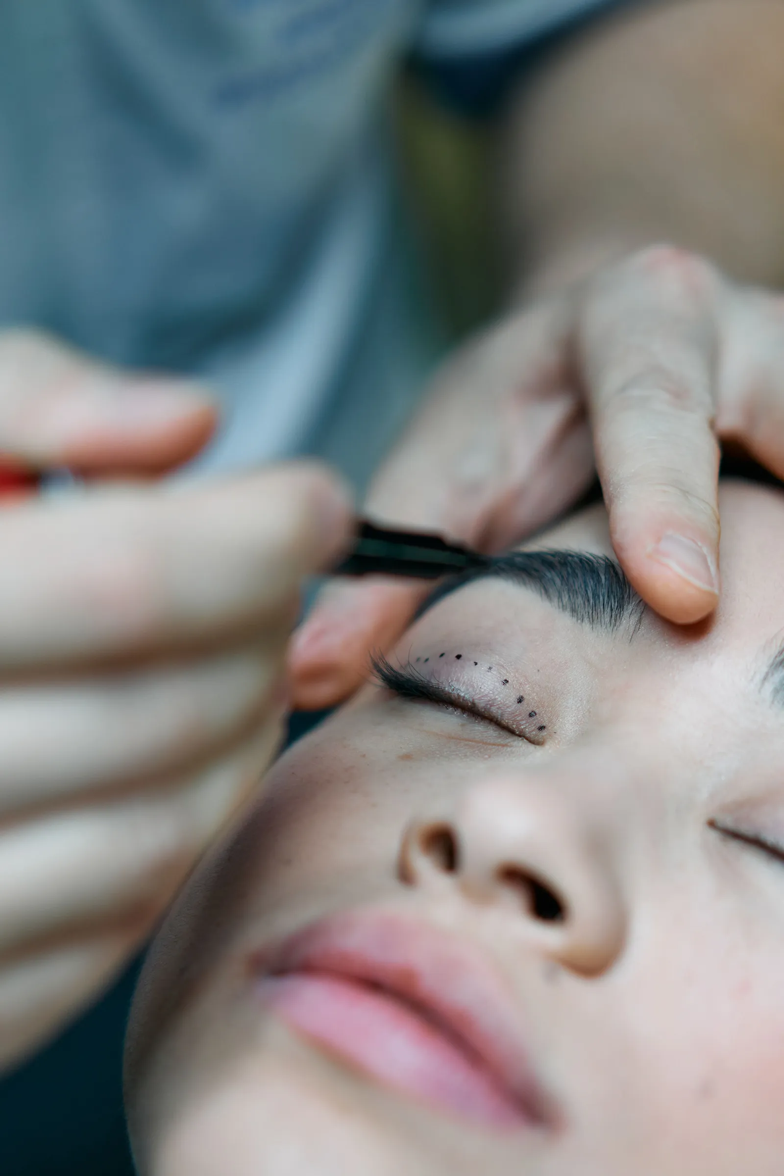 Upper and lower eyelid surgery by Dr. Sharan Shah, facial plastic surgeon in New York City
